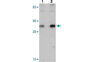 Western blot analysis of PTRF in human spleen tissue with PTRF polyclonal antibody  at (lane 1) 0. (PTRF anticorps  (C-Term))