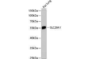 Western blot analysis of extracts of rat lung, using SLC29 antibody (3205) at 1:3000 dilution.