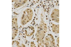Immunohistochemistry of paraffin-embedded human stomach using HNRNPA2B1 Antibody. (HNRNPA2B1 anticorps  (AA 1-180))