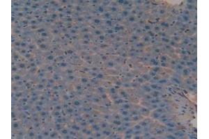 Figure. (Versican anticorps  (AA 3058-3299))