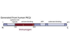 Image no. 2 for anti-Protein Kinase C, beta (PRKCB) (AA 126-324) antibody (ABIN967769) (PKC beta anticorps  (AA 126-324))