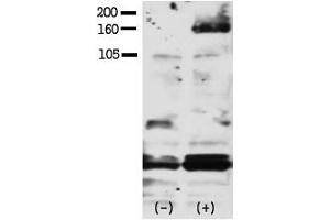 Image no. 1 for anti-V-Erb-A erythroblastic Leukemia Viral Oncogene Homolog 4 (Avian) (ERBB4) (pTyr1188) antibody (ABIN358140) (ERBB4 anticorps  (pTyr1188))