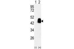 Image no. 2 for anti-Pyruvate Dehydrogenase Complex, Component X (PDHX) antibody (ABIN357415) (PDHX anticorps)