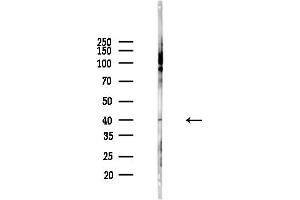 Western blot analysis of lysates from Hela cells(heat-shock,45 min treatment), using IL1R2 Antibody at 1/1000 dilution.