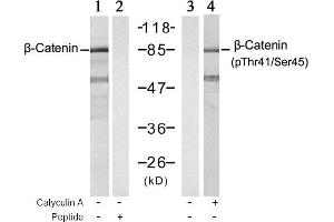 Image no. 1 for anti-Catenin (Cadherin-Associated Protein), beta 1, 88kDa (CTNNB1) (pSer45), (pThr41) antibody (ABIN196815) (CTNNB1 anticorps  (pSer45, pThr41))