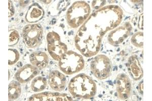 Detection of ALDH1A2 in Human Kidney Tissue using Polyclonal Antibody to Aldehyde Dehydrogenase 1 Family, Member A2 (ALDH1A2)