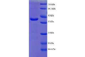 ATP Synthase, H+ Transporting, Mitochondrial F1 Complex, delta Subunit (ATP5D) (AA 43-161), (partial) protein (GST tag)
