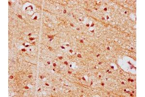 IHC image of ABIN7154356 diluted at 1:500 and staining in paraffin-embedded human brain tissue performed on a Leica BondTM system. (PIGT anticorps  (AA 402-562))
