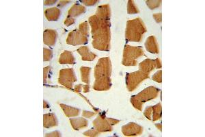 Immunohistochemistry (IHC) image for anti-BMI1 Polycomb Ring Finger Oncogene (BMI1) antibody (ABIN3001536) (BMI1 anticorps)