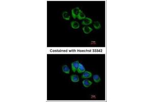 anti-Thyrotropin-Releasing Hormone Receptor (TRHR) (C-Term) antibody