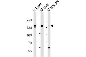 Western blot analysis of lysates from human Liver, mouse Liver, mouse bladder tissue (from left to right), using FGA Antibody (N-term) (ABIN1538750 and ABIN2843856).