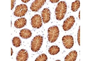 IHC testing of human stomach stained with MUC5AC antibody (45M1). (MUC5AC anticorps)