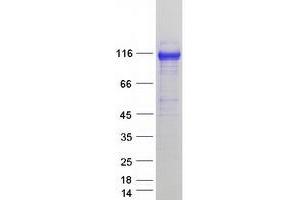 Validation with Western Blot