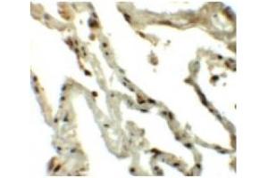 Immunohistochemistry of Translin in Human lung tissue with Translin antibody at 5 µg/ml.