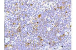 IHC analysis of TFEB using anti-TFEB antibody (ABIN7600648).