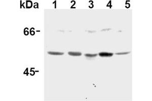 Western Blotting (WB) image for anti-Caspase 12 (Gene/pseudogene) (CASP12) (AA 95-318), (N-Term) antibody (ABIN567795) (Caspase 12 anticorps  (N-Term))