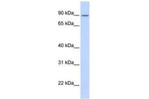 Image no. 1 for anti-Zinc Finger Protein 408 (ZNF408) (AA 576-625) antibody (ABIN6740345) (ZNF408 anticorps  (AA 576-625))