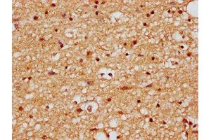 IHC image of ABIN7165514 diluted at 1:200 and staining in paraffin-embedded human brain tissue performed on a Leica BondTM system. (FAM50B anticorps  (AA 98-199))