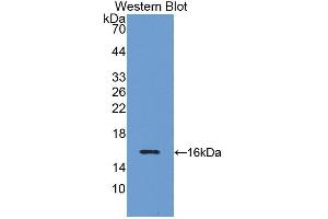 Western blot analysis of the recombinant protein. (INHBB anticorps  (AA 293-407))