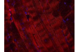 Indirect immunostaining of paraffin embedded sections of mouse skeletal muscle (1 : 200; red). (VAMP5 anticorps  (AA 1-70))