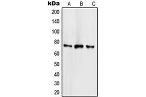 Western blot analysis of SCML2 expression in HeLa (A), NCIH460 (B), Jurkat (C) whole cell lysates. (SCML2 anticorps  (Center))