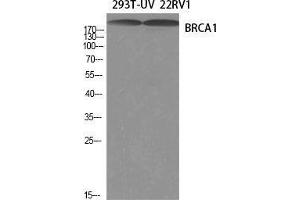 Western Blot (WB) analysis of specific cells using BRCA1 Polyclonal Antibody.