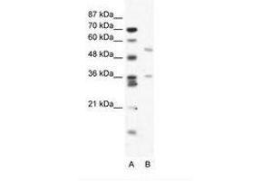 Image no. 1 for anti-BTB (POZ) Domain Containing 3 (BTBD3) (AA 349-398) antibody (ABIN203194) (BTBD3 anticorps  (AA 349-398))