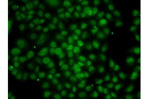 Immunofluorescence analysis of MCF-7 cells using ATMIN antibody (ABIN4902975). (ATM Interactor anticorps)