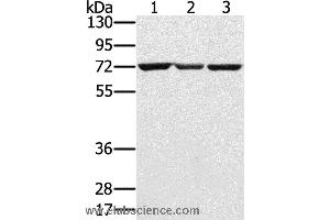 Western blot analysis of Hepg2, A172 and Raji cell, using SLC25A13 Polyclonal Antibody at dilution of 1:450 (slc25a13 anticorps)
