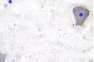 Immunohistochemistry analyzes of GAS3 antibody in paraffin-embedded human brain tissue. (PMP22 anticorps)