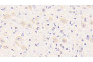 Detection of SCRN1 in Mouse Cerebrum Tissue using Polyclonal Antibody to Secernin 1 (SCRN1)