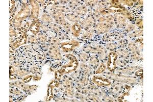 ABIN7093243 and ABIN7097260 at 1/100 staining Rat kidney tissue by IHC-P. (IRF7 anticorps  (pSer479))