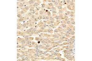 Immunohistochemistry of paraffin embedded rat liver using PTPN2 (ABIN7075295) at dilution of 1:900 (400x lens)