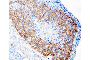 Anti-hCG receptor antibody, IHC(P) IHC(P): Rat Ovary Tissue
