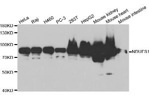 Western blot analysis of extracts of various cell lines, using NDUFS1 antibody (ABIN5971414) at 1/1000 dilution. (NDUFS1 anticorps)