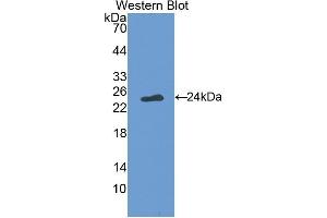 Detection of Recombinant FASL, Simian using Polyclonal Antibody to Factor Related Apoptosis Ligand (FASL) (FASL anticorps  (AA 102-280))