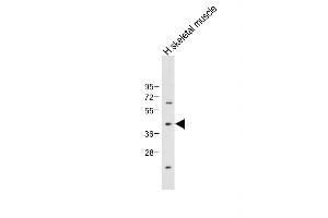 Anti-ADIPOR2 Antibody (Center) at 1:1000 dilution + Human skeletal muscle tissue lysate Lysates/proteins at 20 μg per lane. (Adiponectin Receptor 2 anticorps  (AA 45-72))
