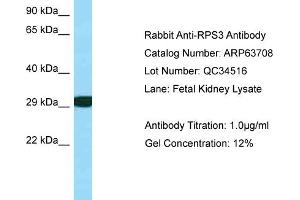 Western Blotting (WB) image for anti-Ribosomal Protein S3 (RPS3) (C-Term) antibody (ABIN971628) (RPS3 anticorps  (C-Term))
