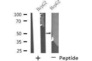 Western blot analysis of extracts from HepG2 cells using PPP4R1L antibody. (PPP4R1L anticorps)