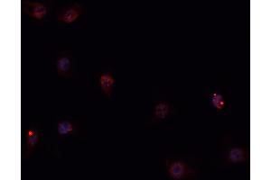 ABIN6269258 staining Hep G2 cells by IF/ICC. (GATA4 anticorps  (Internal Region))
