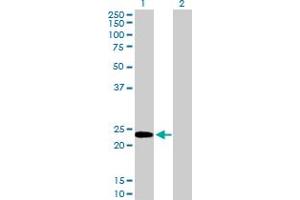 Western Blot analysis of HMGB3 expression in transfected 293T cell line by HMGB3 MaxPab polyclonal antibody.