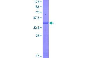 Image no. 1 for Interleukin 4 Receptor (IL4R) (AA 26-135) protein (GST tag) (ABIN1307828)