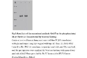 Western Blotting (WB) image for anti-Retinoblastoma 1 (RB1) (pThr821) antibody (ABIN3201013) (Retinoblastoma 1 anticorps  (pThr821))