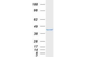 Validation with Western Blot