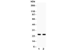 Western blot testing of Rab3A antibody and Lane 1:  rat brain;  2: mouse brain lysate (RAB3A anticorps  (AA 192-220))