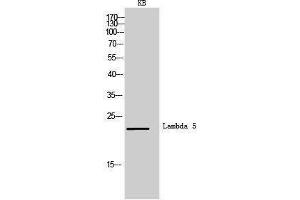 Western Blotting (WB) image for anti-Immunoglobulin lambda-Like Polypeptide 1 (IGLL1) (Internal Region) antibody (ABIN3181479) (IGLL1 anticorps  (Internal Region))