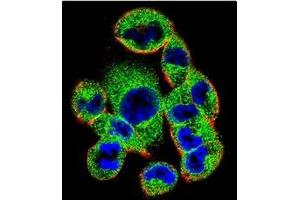 Confocal Immunofluorescent analysis of SOCS4 antibody (Center) Cat.