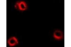 Immunofluorescent analysis of APEH staining in Hela cells.