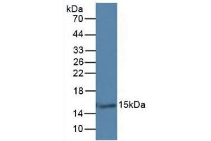 Mouse Capture antibody from the kit in WB with Positive Control: Rat Skin Tissue.