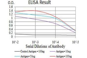 Black line: Control Antigen (100 ng);Purple line: Antigen (10ng); Blue line: Antigen (50 ng); Red line:Antigen (100 ng)